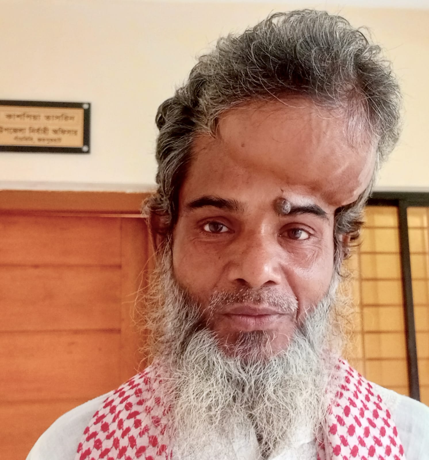 মাথায় টিউমার আক্রান্ত জয়নাল বাঁচতে চায়  ‎